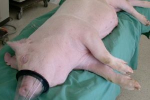 Zemra e derrit mund të transplantohet te njerëzit e sëmurë