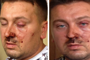 Qëlluan drejt banesës së tij, tre vite më parë Juxhin Kulla akuzoi shefin e policisë se e ka dhunuar