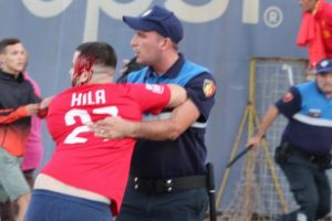 Dhuna para derbit të kryeqytetit, policia arreston 1 person, në kërkim 2 të tjerë